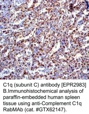 RB MAB TO C1Q (SUBUNIT C)