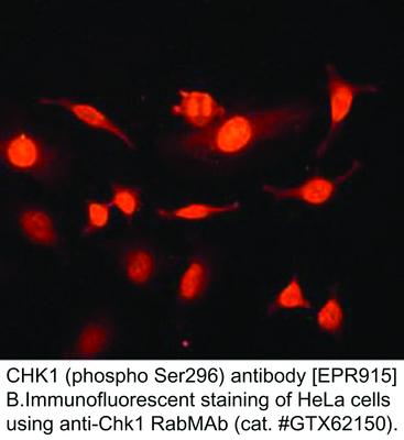 CHK1 (phospho Ser296) antibody [EPR915], GeneTex