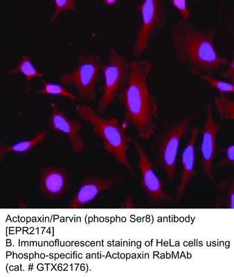 RB MAB TO ACTOPAXIN/PARVIN PS8