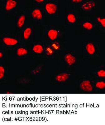 Ki-67 antibody [EPR3611], GeneTex