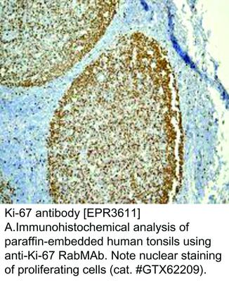 Ki-67 antibody [EPR3611], GeneTex