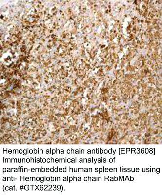 Hemoglobin alpha chain antibody [EPR3608], GeneTex