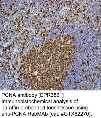 PCNA antibody [EPR3821], GeneTex