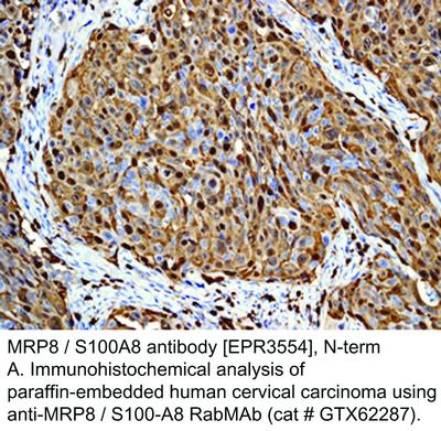 MRP8 / S100A8 antibody [EPR3554], N-term, GeneTex