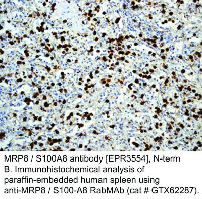 MRP8 / S100A8 antibody [EPR3554], N-term, GeneTex