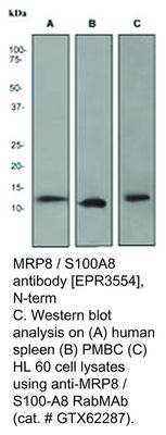 MRP8 / S100A8 antibody [EPR3554], N-term, GeneTex