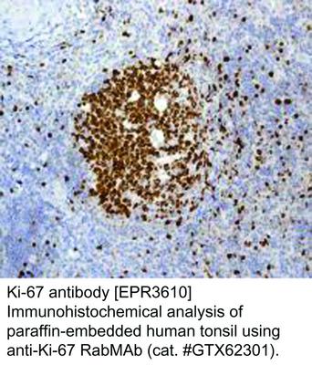 Ki-67 antibody [EPR3610], GeneTex