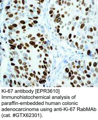 Ki-67 antibody [EPR3610], GeneTex