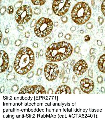 Slit2 antibody [EPR2771], GeneTex