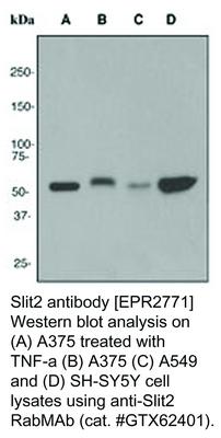 Slit2 antibody [EPR2771], GeneTex