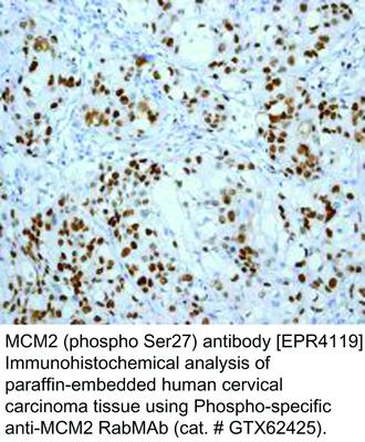 MCM2 (phospho Ser27) antibody [EPR4119], GeneTex