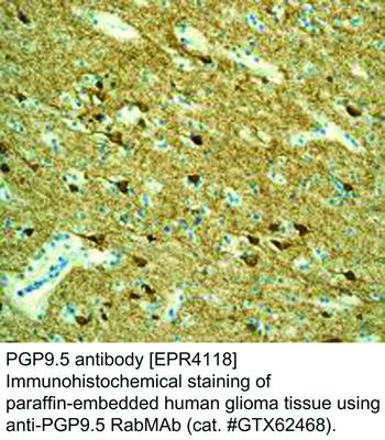 PGP9.5 antibody [EPR4118], GeneTex