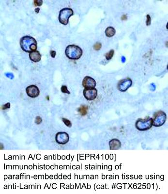 Lamin A/C antibody [EPR4100], GeneTex