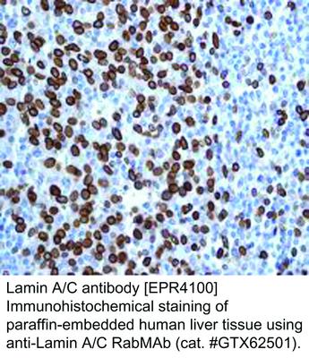 Lamin A/C antibody [EPR4100], GeneTex