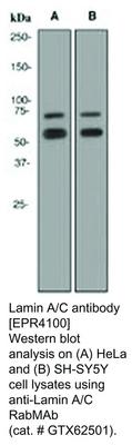 Lamin A/C antibody [EPR4100], GeneTex