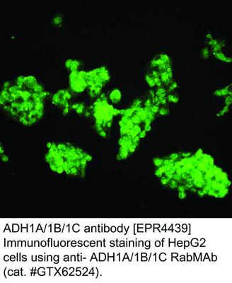 ADH1A/1B/1C antibody [EPR4439], GeneTex