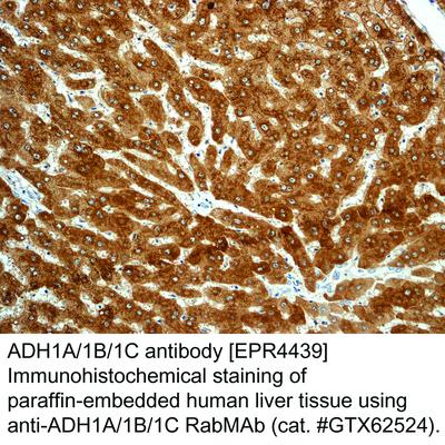 ADH1A/1B/1C antibody [EPR4439], GeneTex