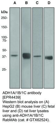 ADH1A/1B/1C antibody [EPR4439], GeneTex