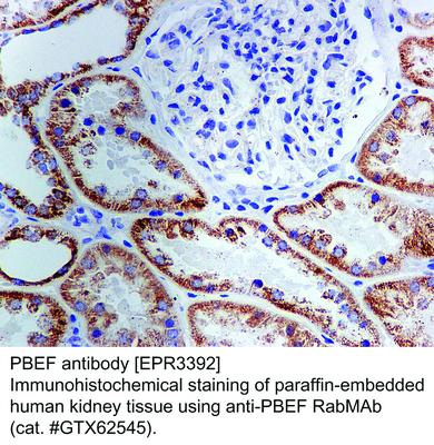 PBEF antibody [EPR3392], GeneTex