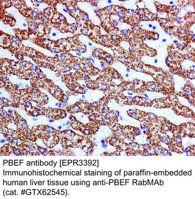 PBEF antibody [EPR3392], GeneTex