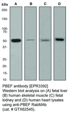 PBEF antibody [EPR3392], GeneTex