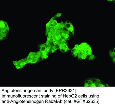 RB MAB TO ANGIOTENSINOGEN