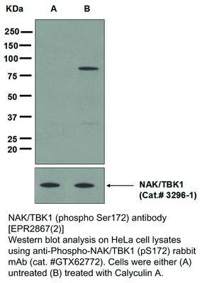 RB MAB TO NAK/TBK1 (S172)