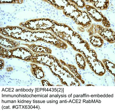 ACE2 antibody [EPR4435(2)], GeneTex