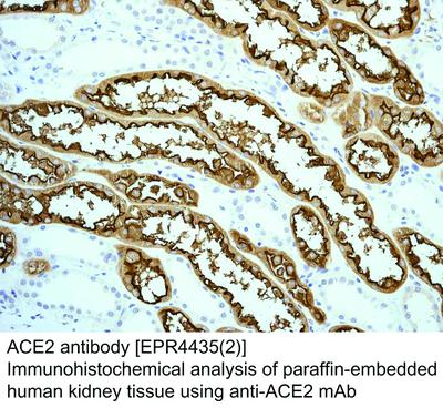 ACE2 antibody [EPR4435(2)], GeneTex