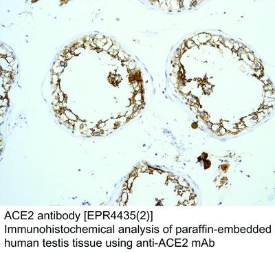 ACE2 antibody [EPR4435(2)], GeneTex