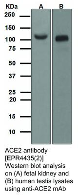 ACE2 antibody [EPR4435(2)], GeneTex