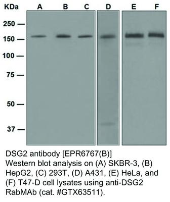 DSG2 antibody [EPR6767(B)], GeneTex