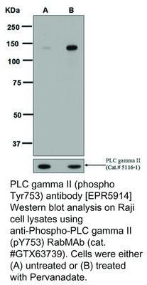 RB MAB TO PLC GAMMA II (Y753)