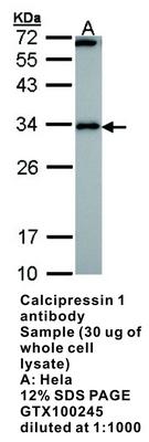 Calcipressin 1 antibody, GeneTex