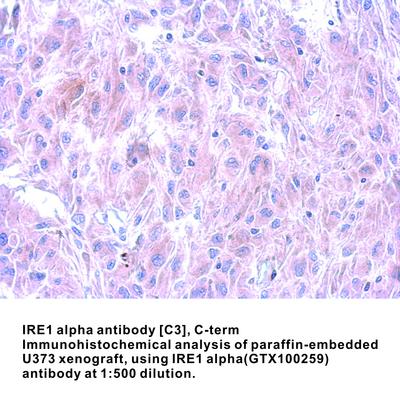 IRE1 alpha antibody [C3], C-term, GeneTex