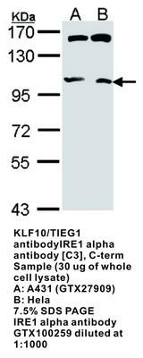 IRE1 alpha antibody [C3], C-term, GeneTex