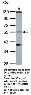 RB PAB TO DOPAMINE RECEPTOR D1