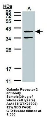 RB PAB TO GALANIN RECEPTOR 2