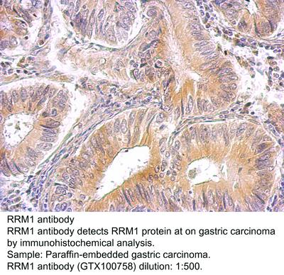 RB PAB TO RRM1