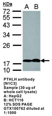 B-Raf antibody [N2C1], Internal, GeneTex