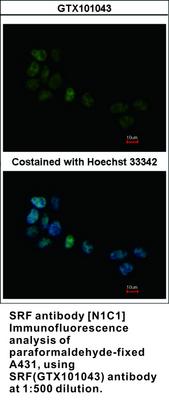 SRF antibody [N1C1], GeneTex