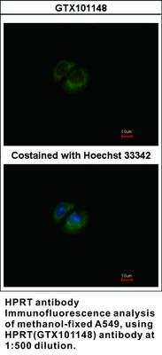 HPRT antibody, GeneTex