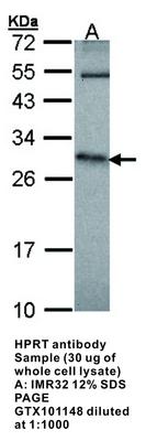 HPRT antibody, GeneTex