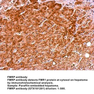 FMRP antibody - Rabbit Polyclonal - ICC/IF, WB, GeneTex