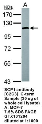 SCP1 antibody [C2C3], C-term, GeneTex