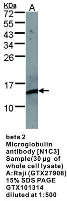 beta 2 Microglobulin antibody [N1C3], GeneTex