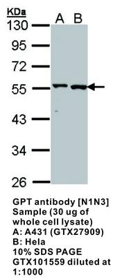 GPT antibody [N1N3], GeneTex