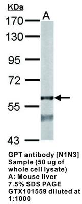 GPT antibody [N1N3], GeneTex