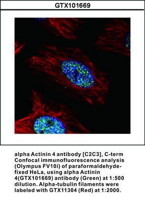 alpha Actinin 4 antibody [C2C3], C-term, GeneTex