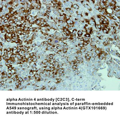 alpha Actinin 4 antibody [C2C3], C-term, GeneTex